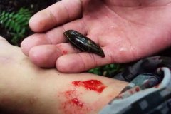 螞蟥咬人怎么辦？螞蟥怎么能殺死？